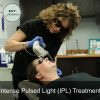 IPL Photofacial - Image 3