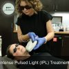 IPL Photofacial - Image 2