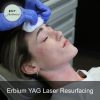 Erbium YAG Laser Resurfacing - Image 3