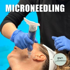 Microneedling