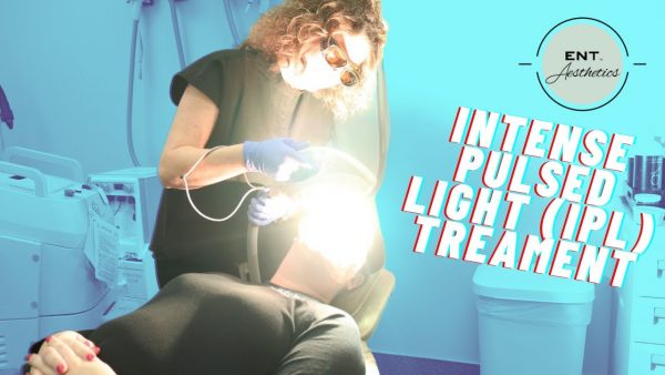 IPL Photofacial