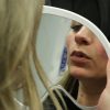 Restylane Kysse - Image 2