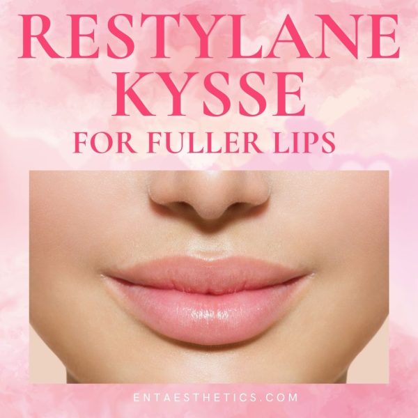 Restylane Kysse